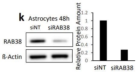 Astrocytes were examined by Western blot analysis for RAB38 expression.jpg